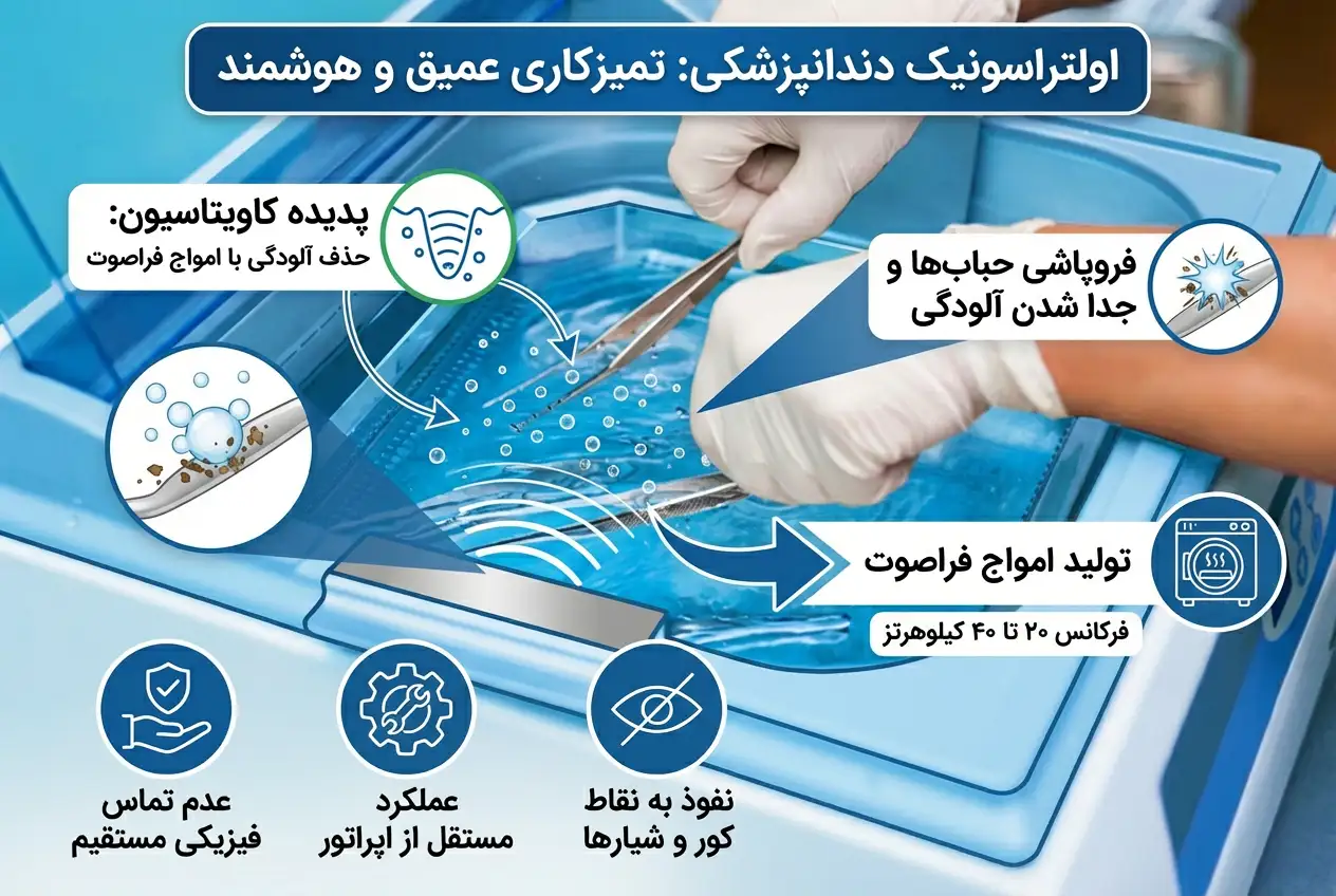اولتراسونیک دندانپزشکی چگونه کار میکند