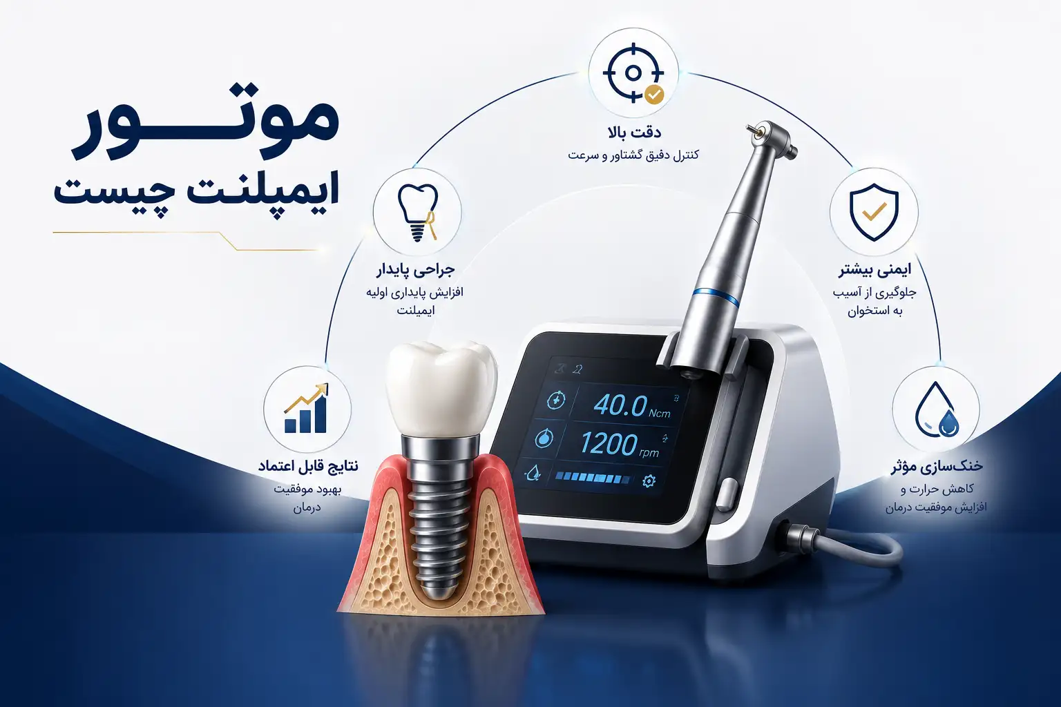 موتور ایمپلنت چیست